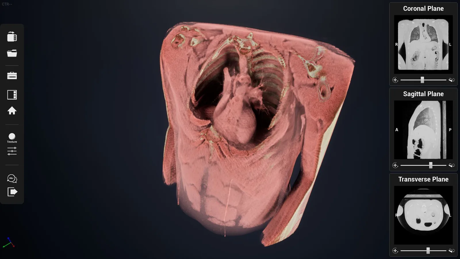 A volume-rendered chest CT beside its coronal, sagittal and transverse
                    slices, each with its own contrast slider.