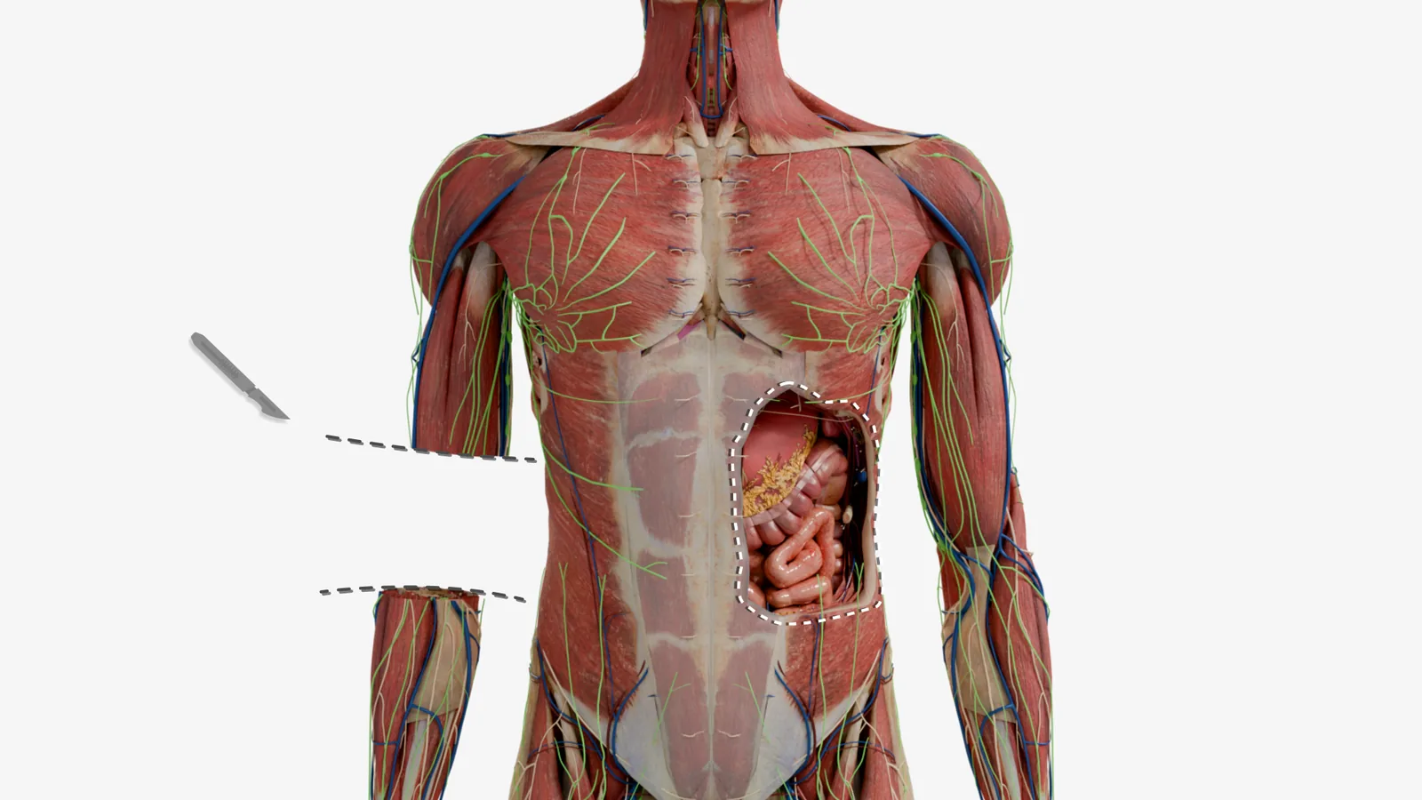 A torso model with the abdominal wall opened along a dashed cutting line to
                    expose the intestines, a scalpel icon marking where the incision begins.