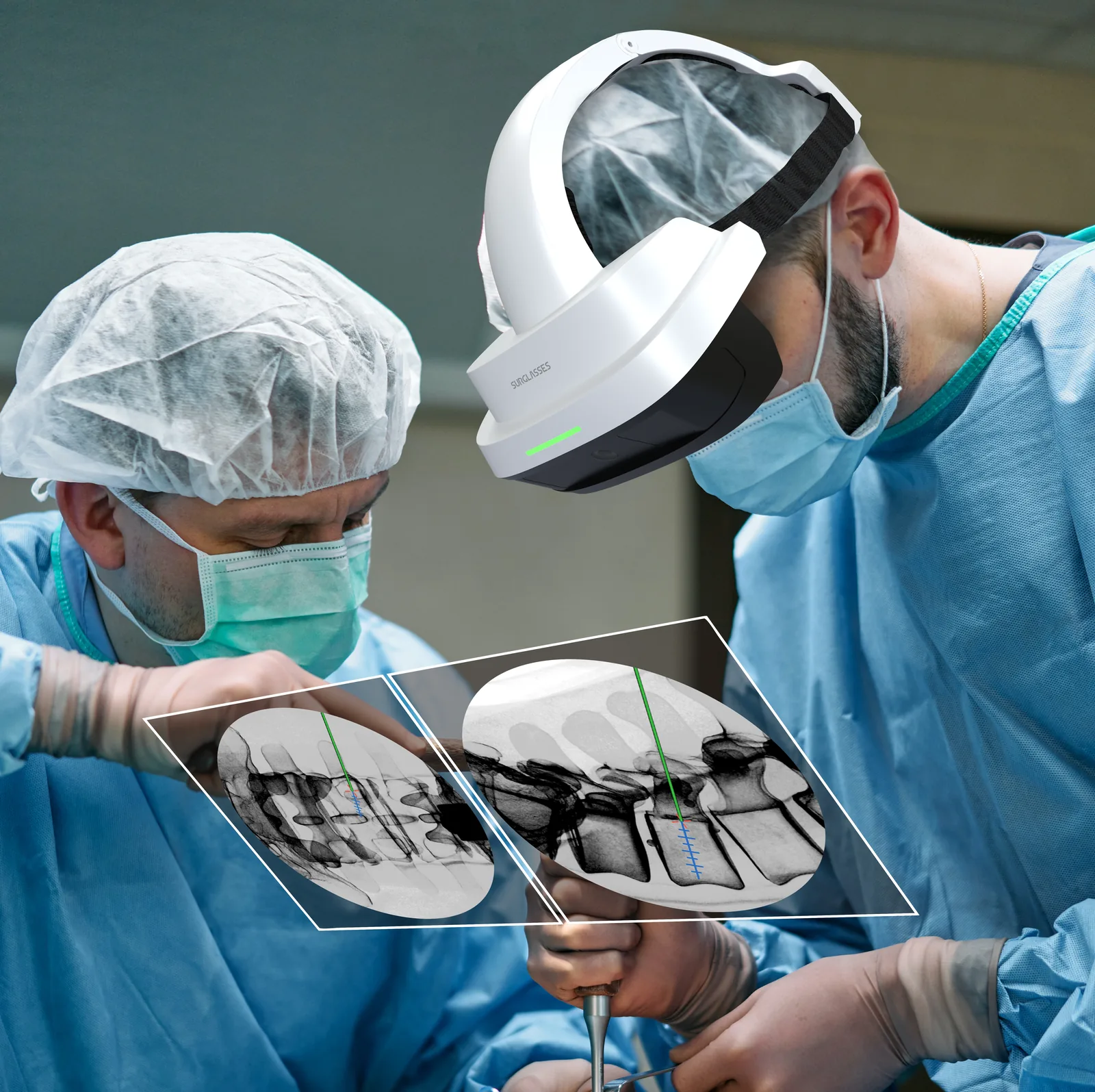 Two surgeons bent over a patient, one wearing the Caduceus S headset. A
                  floating panel in front of them shows two fluoroscopy views of a lumbar
                  spine, each with a green trajectory line and a blue graduated depth scale
                  running into a vertebral body.