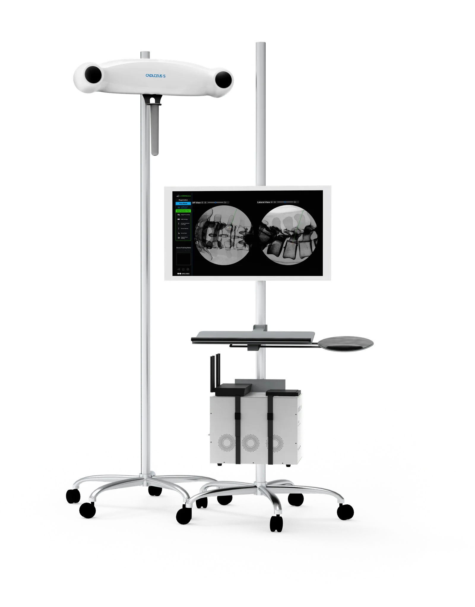 The Caduceus S system: a tracking camera on a wheeled stand beside a second
                  cart carrying a touchscreen, which shows AP and lateral fluoroscopy views of
                  a lumbar spine with a planned trajectory line drawn through a vertebra.