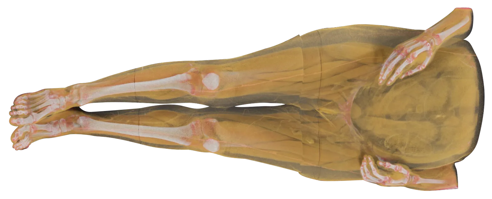 A whole-body CT volume rendered in soft-tissue mode, the skin and muscle
                  translucent enough to show the skeleton and joints through it.