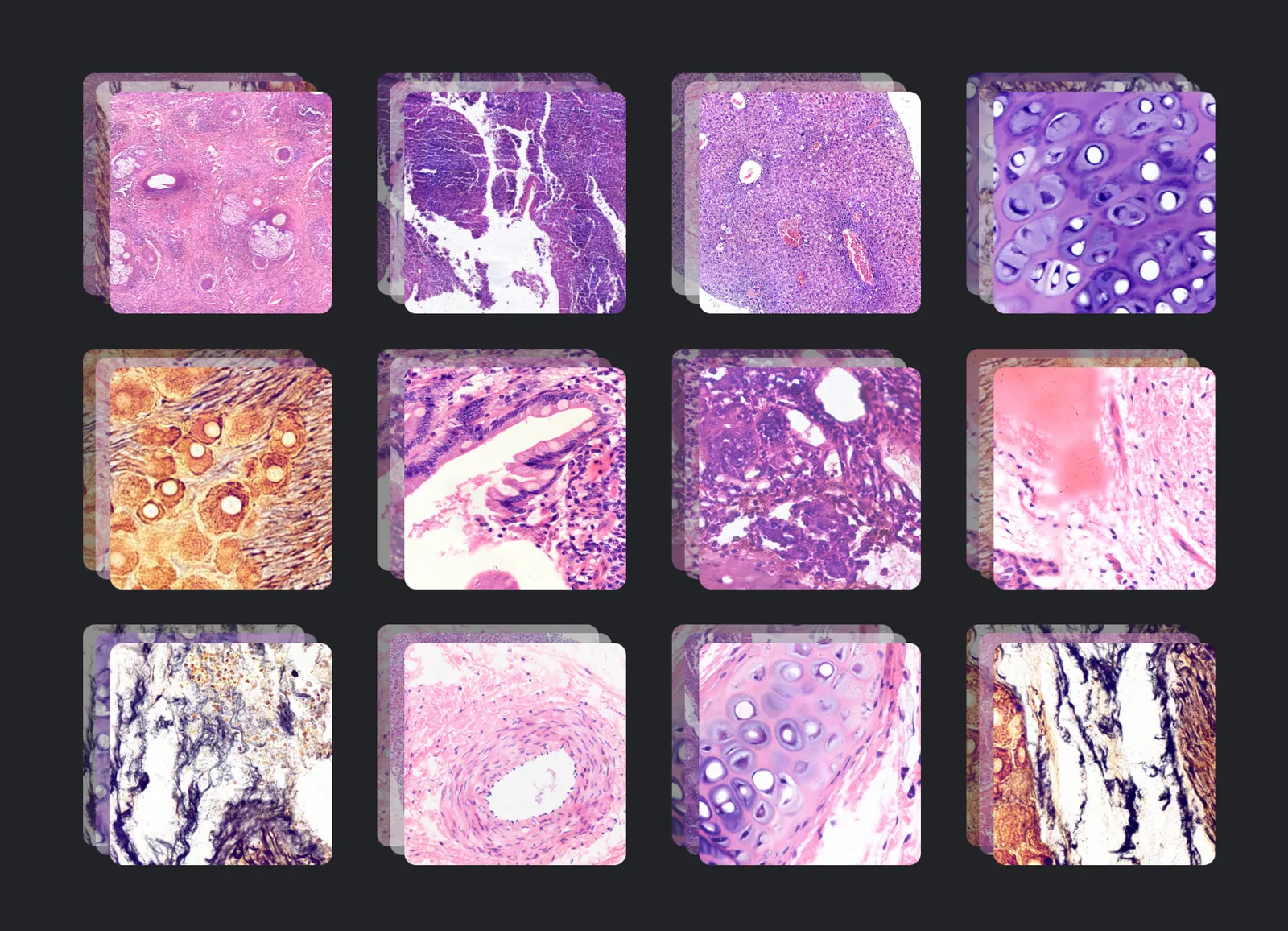 Twelve stained tissue slides laid out as a grid of stacked cards &mdash;
                  cartilage, lymphoid tissue, glandular epithelium, nerve and vessel sections
                  among them &mdash; each one a separate entry in the slide library.