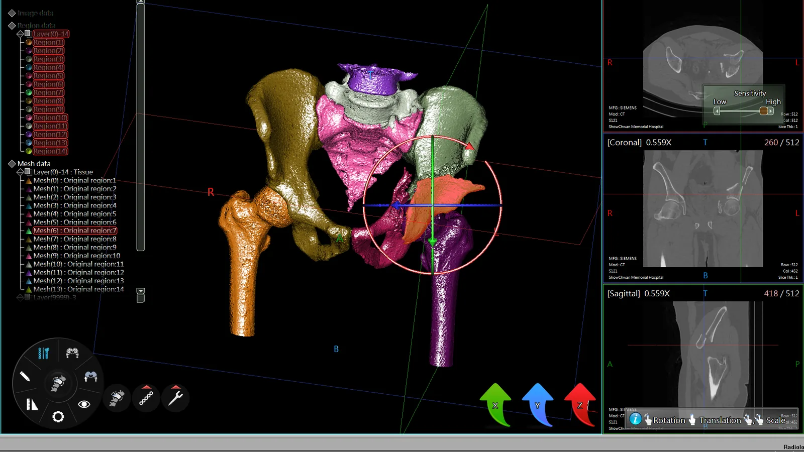 A CT study of the pelvis reconstructed in Asclepius Radiology, each bone
                  segmented in its own colour, with the axial, coronal and sagittal DICOM
                  views alongside.
