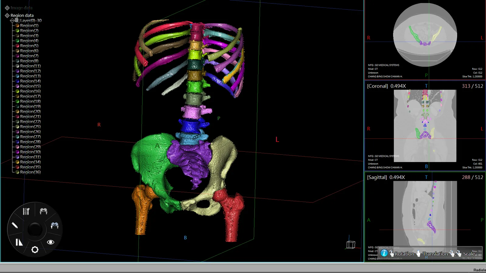 A spine and pelvis reconstruction with a region list down the left side and
                    the DICOM slice views on the right.