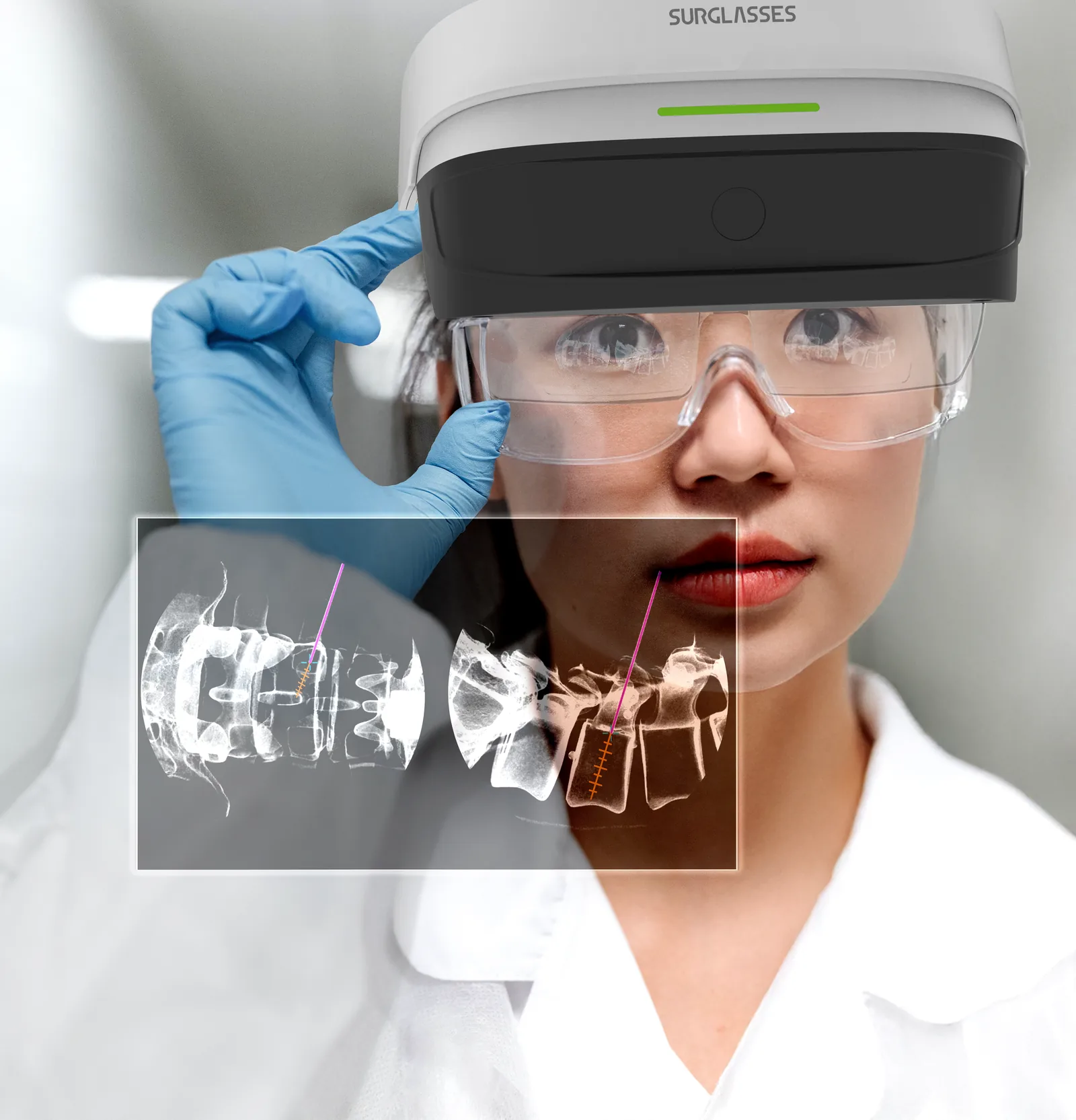 A clinician in a white coat and safety glasses lifting a Caduceus S headset
                  onto her head with a gloved hand, a translucent panel of two spine
                  radiographs with planned trajectories floating in front of her.