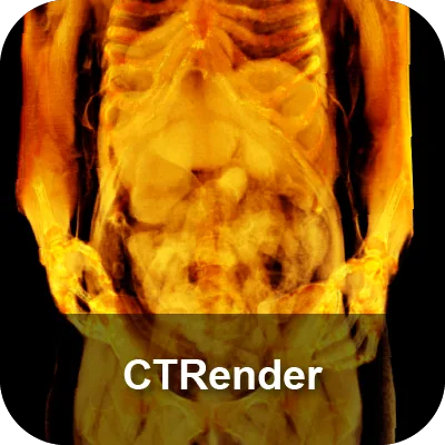 CTRender module: a volume-rendered torso reconstructed from CT data.