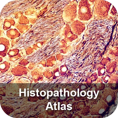 Histopathology Atlas module: a stained tissue section at high
                    magnification.