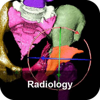 Radiology module: a colour-coded 3D reconstruction of the pelvis with
                    measurement crosshairs.